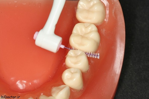نکات بهداشتی مراقبت از دندان ها