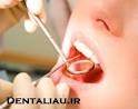 نکات جالب در مورد بهداشت دندانها